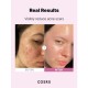 Cosrx - The Niacinamide 15 Serum 20ml - Korean Skin Care